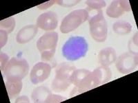 image of blood_cell