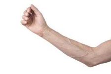image of arm #10