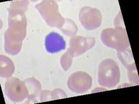 image of blood_cell