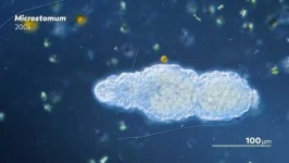 image of parasitic_flatworms