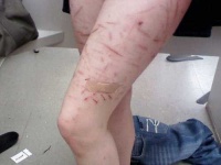 image of band_aid