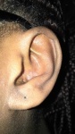 image of ear
