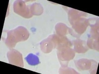 image of blood_cell