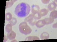 image of blood_cell