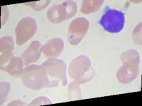 image of blood_cell