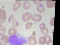 image of blood_cell
