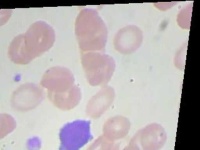 image of blood_cell