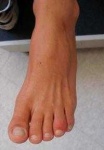 image of toe #6