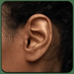 image of ear