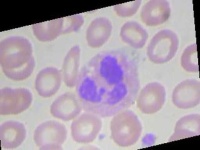 image of blood_cell