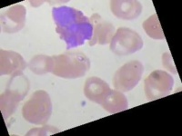 image of blood_cell