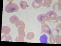 image of blood_cell