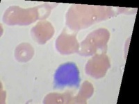 image of blood_cell