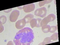 image of blood_cell