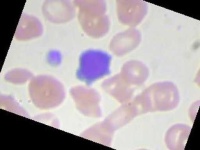 image of blood_cell