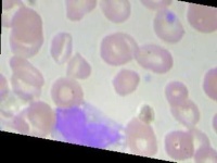 image of blood_cell
