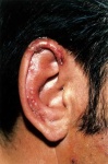 image of ear
