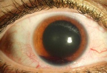 image of eye #5