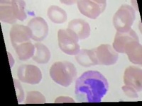 image of blood_cell