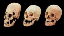image of skull