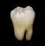 image of tooth #21