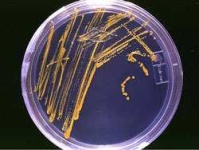 image of petri_dish