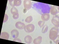 image of blood_cell