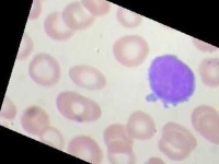 image of blood_cell
