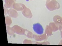 image of blood_cell
