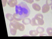 image of blood_cell