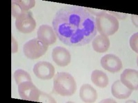 image of blood_cell