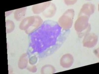 image of blood_cell