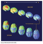 image of brain