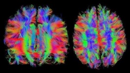 image of brain