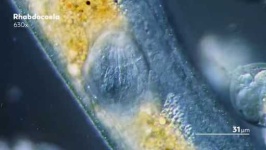 image of parasitic_flatworms