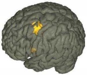 image of brain