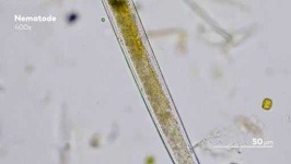 image of parasitic_flatworms