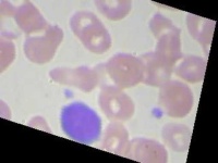 image of blood_cell