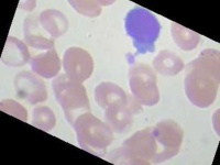 image of blood_cell