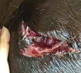 image of stitches