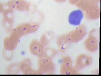image of blood_cell