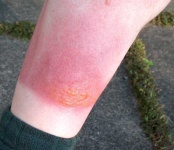 image of sunscreen