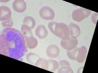 image of blood_cell