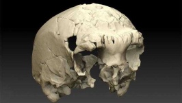 image of skull