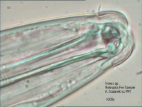 image of nematode