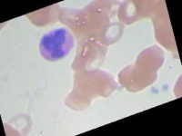 image of blood_cell