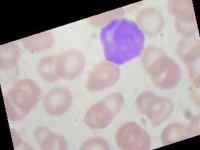 image of blood_cell