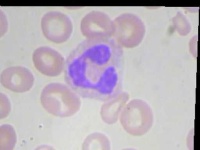 image of blood_cell