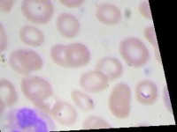 image of blood_cell