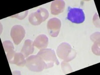 image of blood_cell